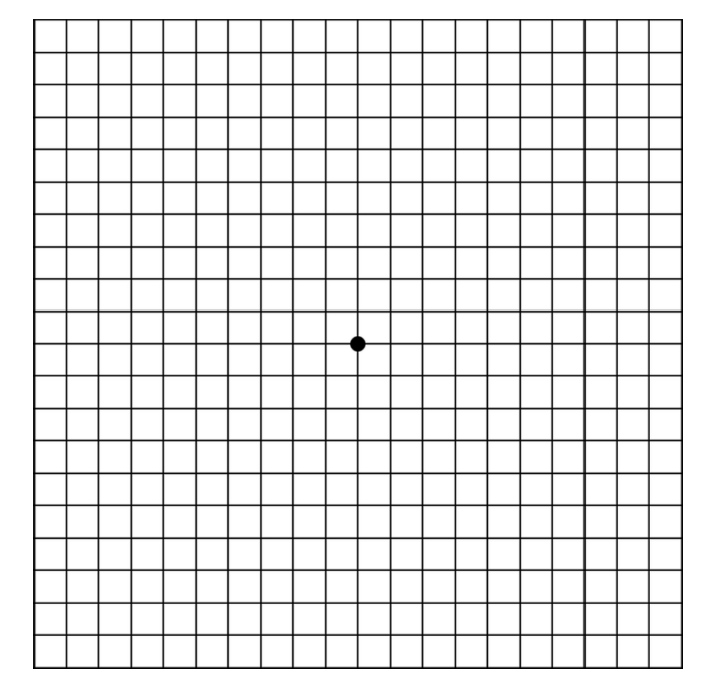 Rejilla de Amsler para el test